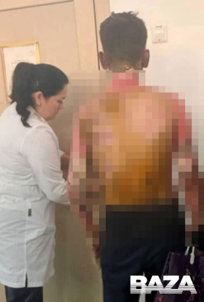 В Красноярске школьница облила одноклассника бензином и подожгла